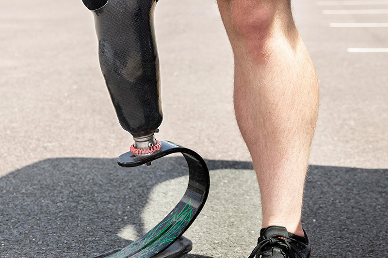 Prosthetics